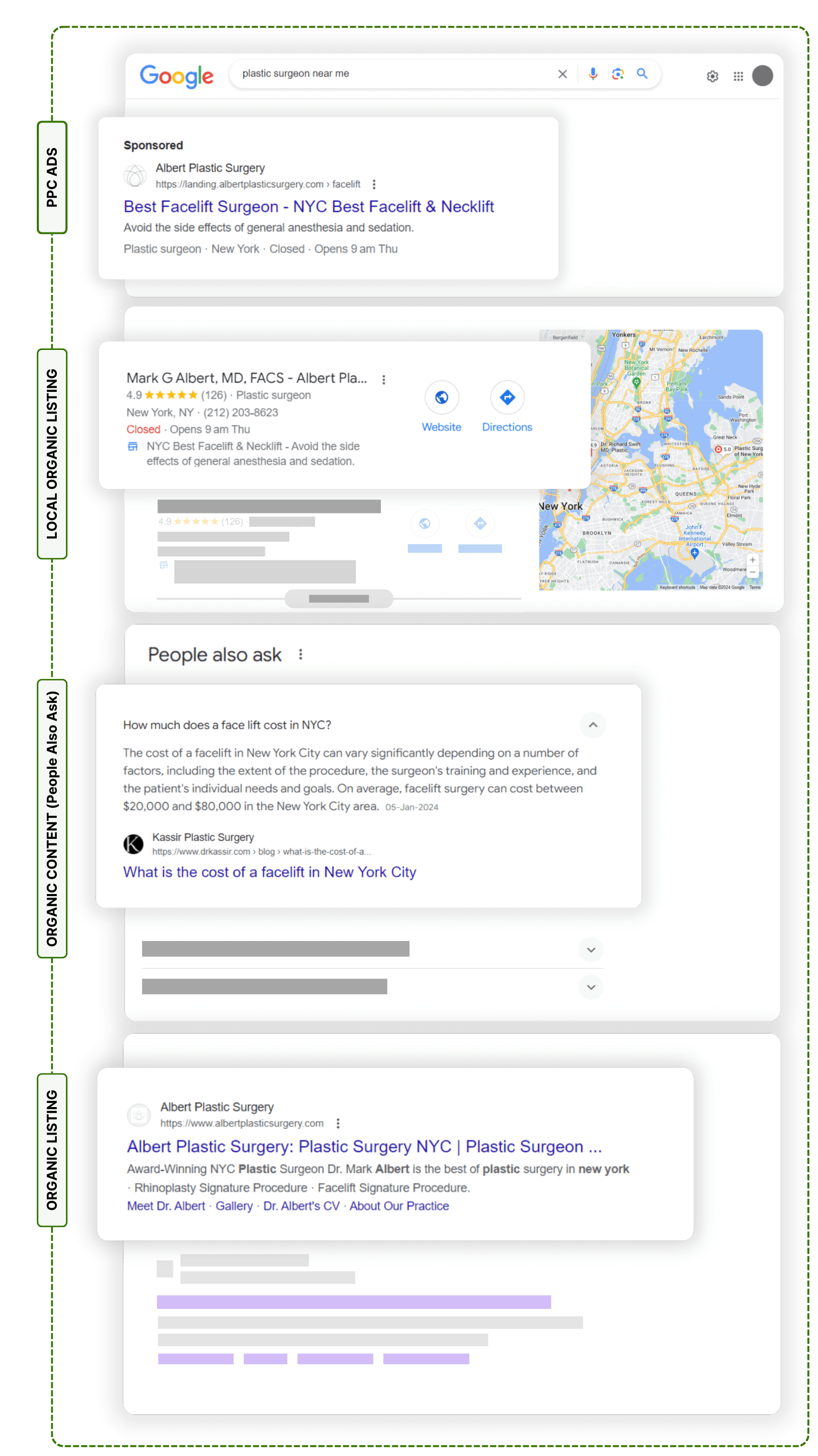 Local SEO for plastic surgeons - SERP image for plastic surgeons